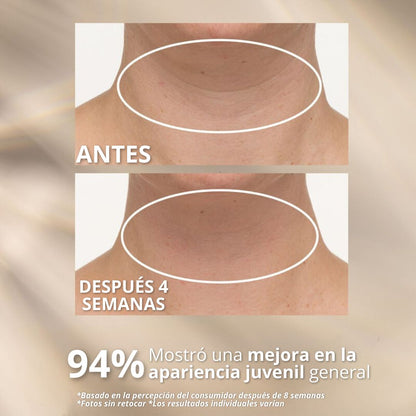 NectiDerm™ – Crema Reafirmante para Cuello y Papada | Efecto Lifting Visible