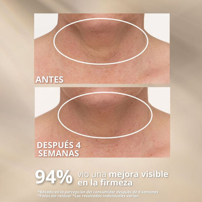 NectiDerm™ – Crema Reafirmante para Cuello y Papada | Efecto Lifting Visible