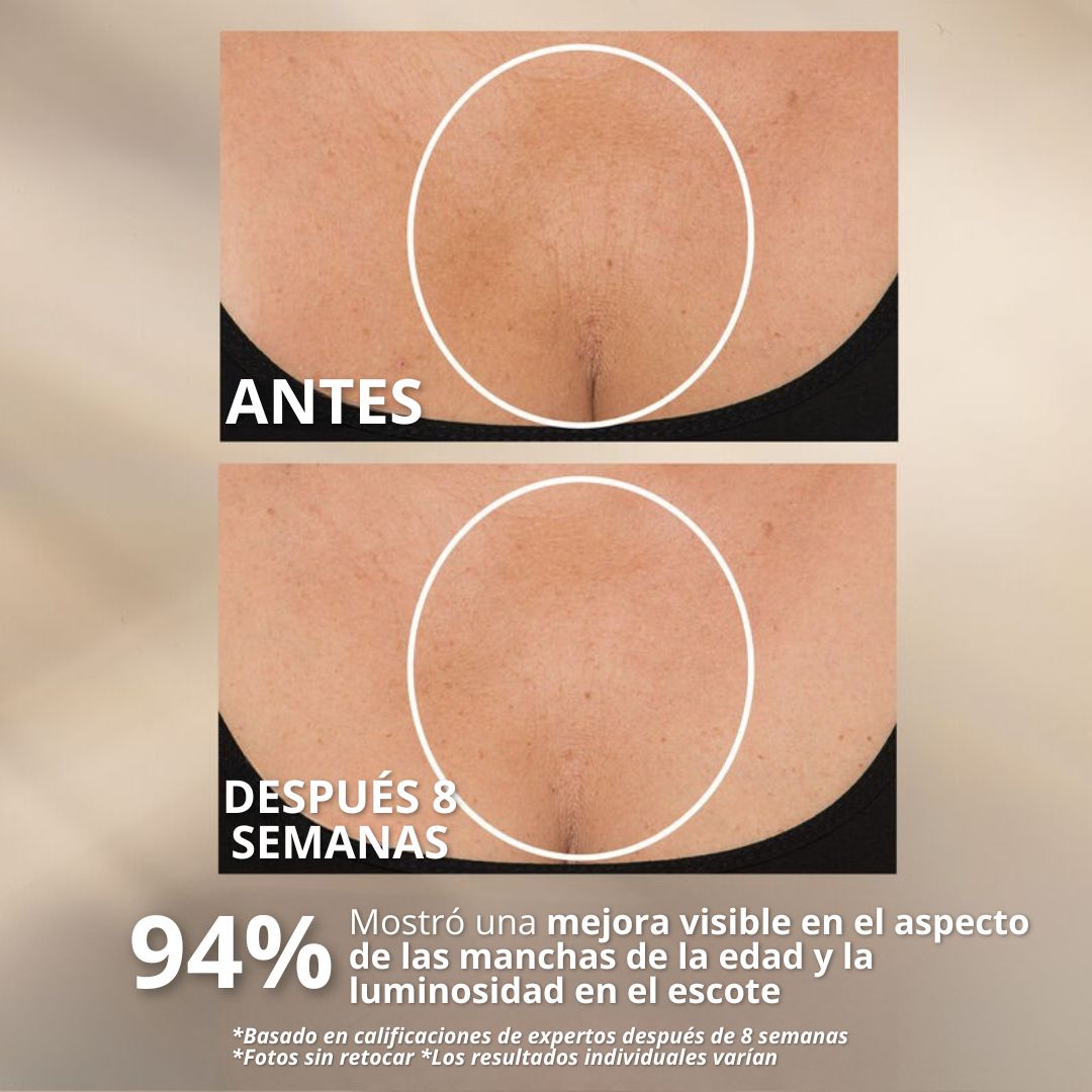NectiDerm™ – Crema Reafirmante para Cuello y Papada | Efecto Lifting Visible